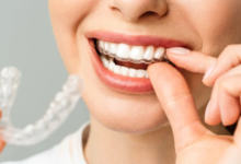 Top Benefits of Choosing Misaligned for a Straighter Smile