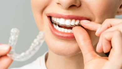 Top Benefits of Choosing Misaligned for a Straighter Smile