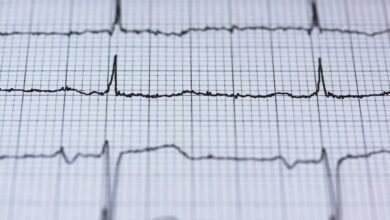 leadership in infinite orbit